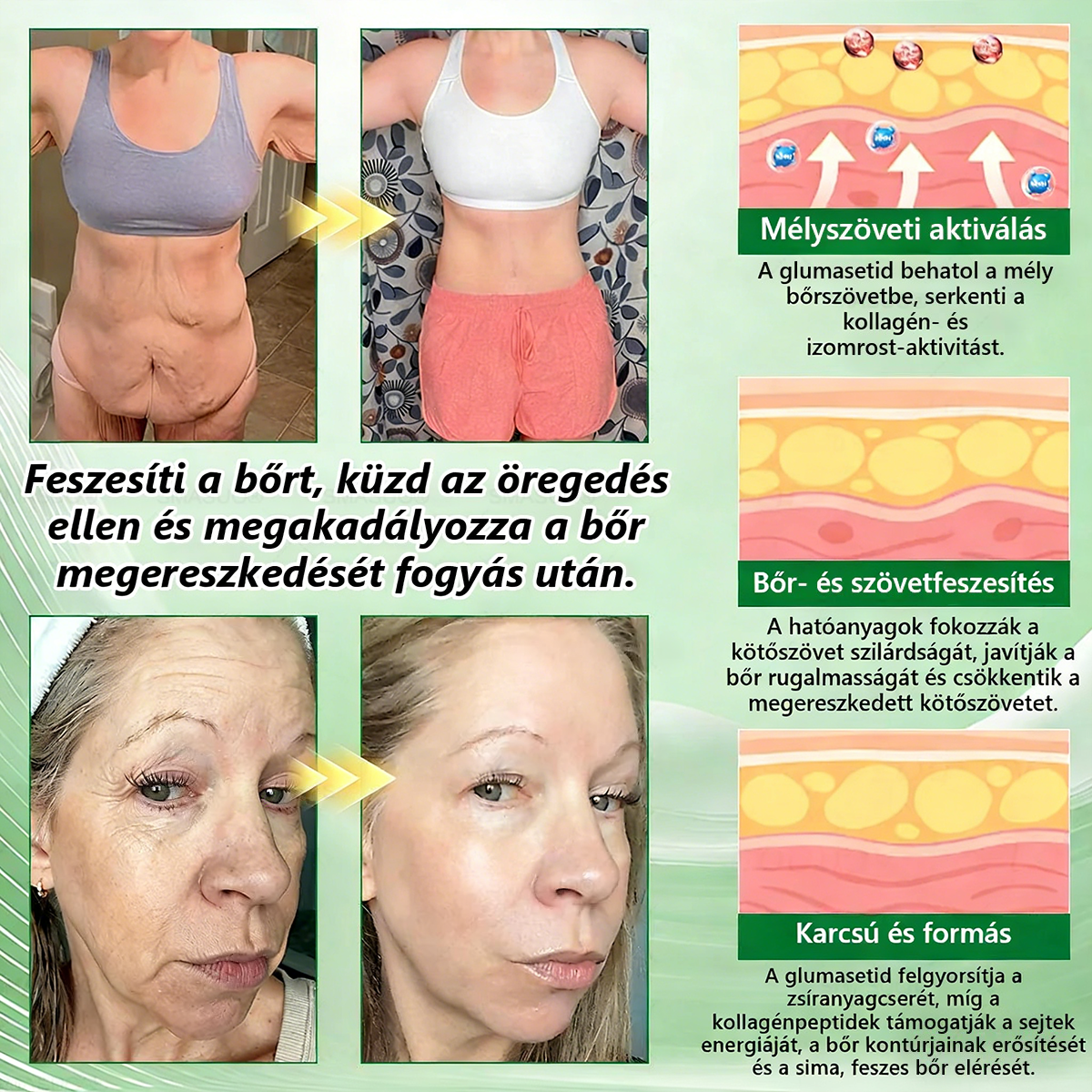 🍃Ajánlott a Semmelweis Kórház által · 👩‍⚕️BENU hivatalos üzlet| 🎁 Pureluxo® Glumasetide 8 az 1-ben Karcsú és Egészséges Nano Mikrotűs Tapasz 🎁🎁