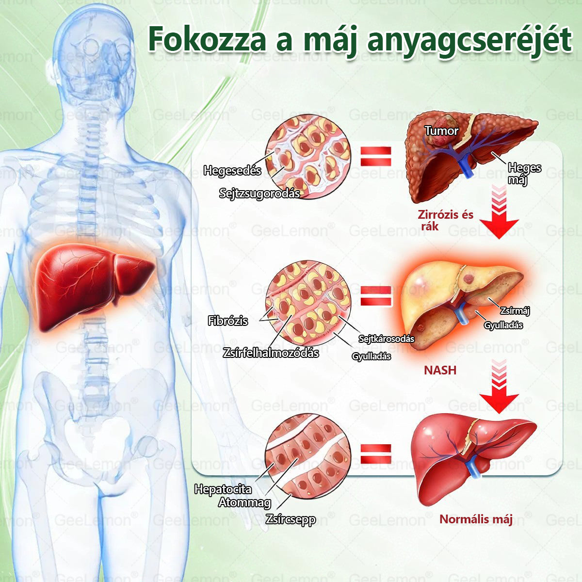 🎄🎄Ajánlott a Semmelweis Kórház által · 👩‍⚕️BENU hivatalos üzlet| 🎁 𝐆𝐞𝑒𝐿𝑒𝐦𝐨𝐧® Glumasetide 8 az 1-ben Karcsú és Egészséges Nano Mikrotűs Tapasz  🎁