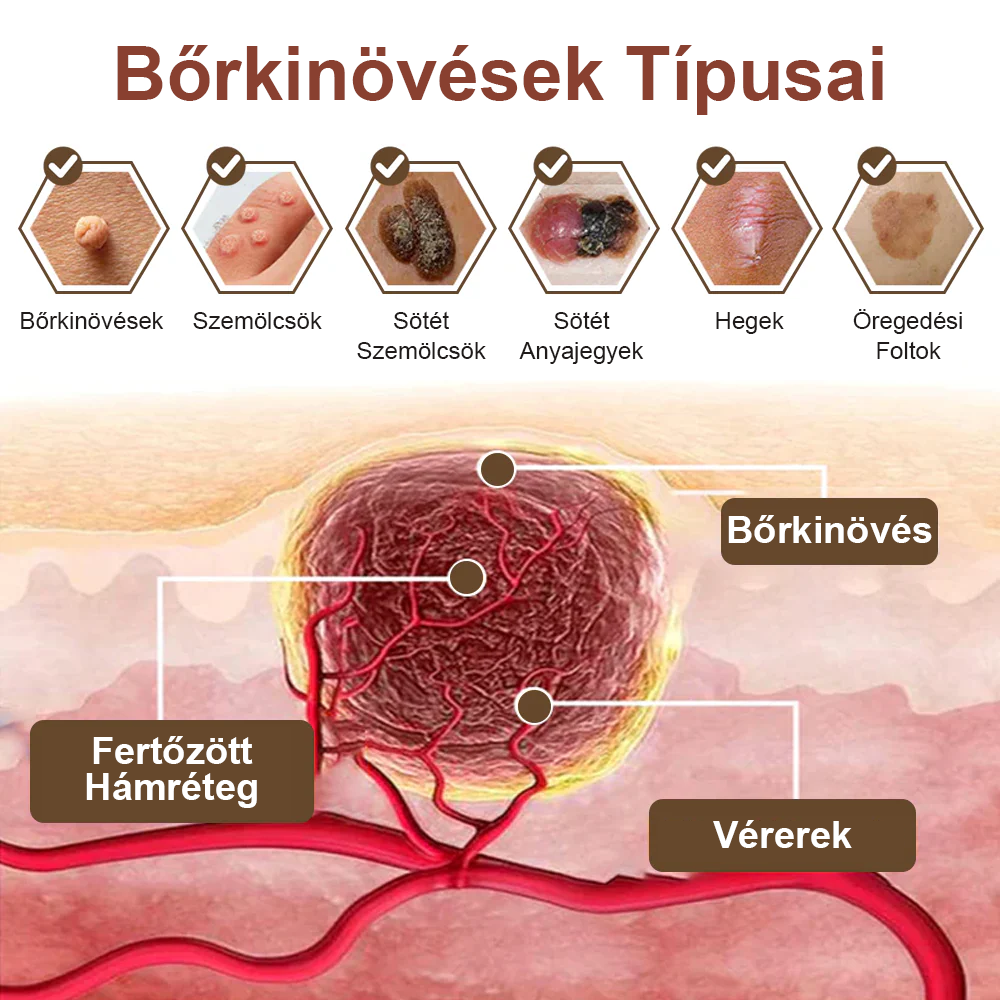 ✅ Pureluxo® Fekete Rizses Bőrregeneráló Krém 👨‍⚕️ (Szemölcsök, bőrkinövések, foltok és hiperpigmentáció kezelésére)✅✅