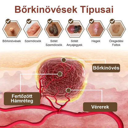 ✅ Pureluxo® Fekete Rizses Bőrregeneráló Krém 👨‍⚕️ (Szemölcsök, bőrkinövések, foltok és hiperpigmentáció kezelésére)✅✅