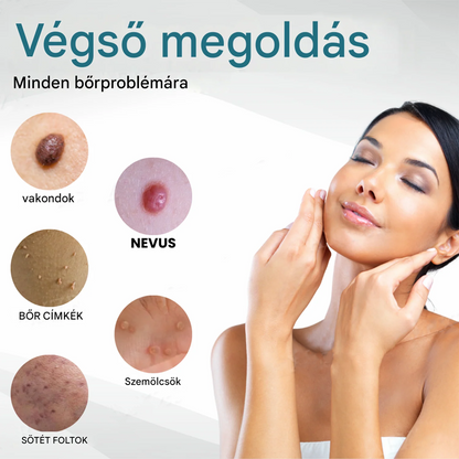 Pureluxo® non-invazív anyajegy- és szemölcseltávolító lézertoll✨