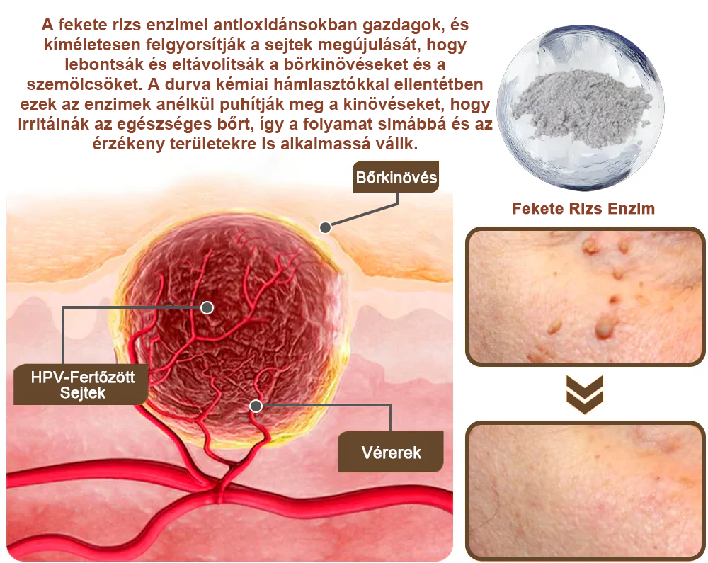 ✅ Pureluxo® Fekete Rizses Bőrregeneráló Krém 👨‍⚕️ (Szemölcsök, bőrkinövések, foltok és hiperpigmentáció kezelésére)✅✅