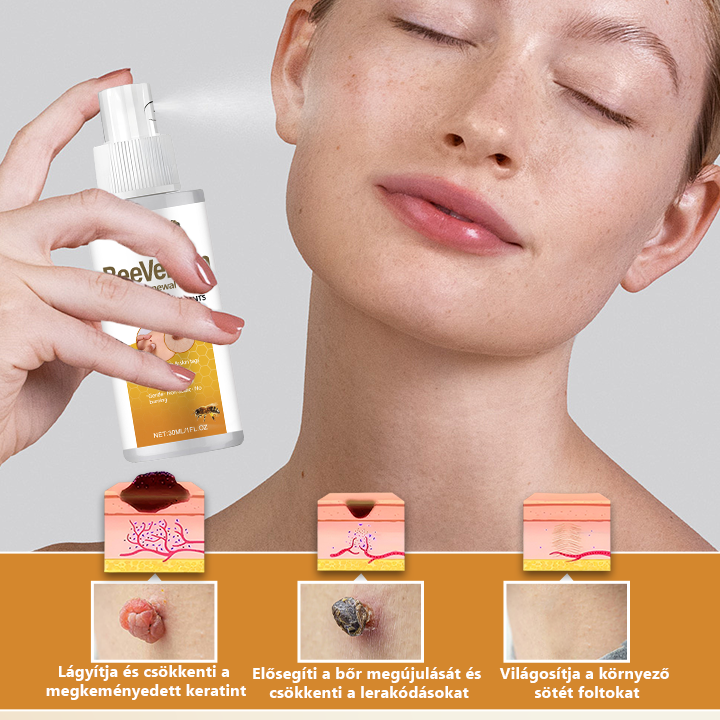 Pureluxo® BeeVenom Szemölcs Megújító Spray 🇭🇺
