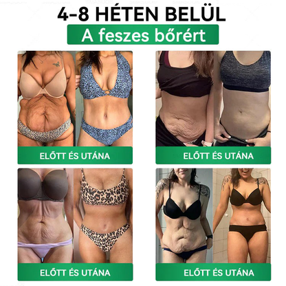 🍃Ajánlott a Semmelweis Kórház által · 👩‍⚕️BENU hivatalos üzlet| 🎁 Pureluxo® Glumasetide 8 az 1-ben Karcsú és Egészséges Nano Mikrotűs Tapasz 🎁🎁