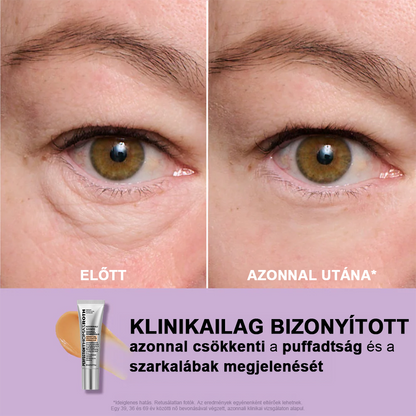 🌸Azonnali Szemkörnyék-Feszesítő Könnyű Formula – Végső Emelés és Sima Befejezés ✨