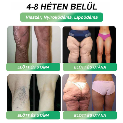 🍃Ajánlott a Semmelweis Kórház által · 👩‍⚕️BENU hivatalos üzlet| 🎁 Pureluxo® Glumasetide 8 az 1-ben Karcsú és Egészséges Nano Mikrotűs Tapasz 🎁🎁