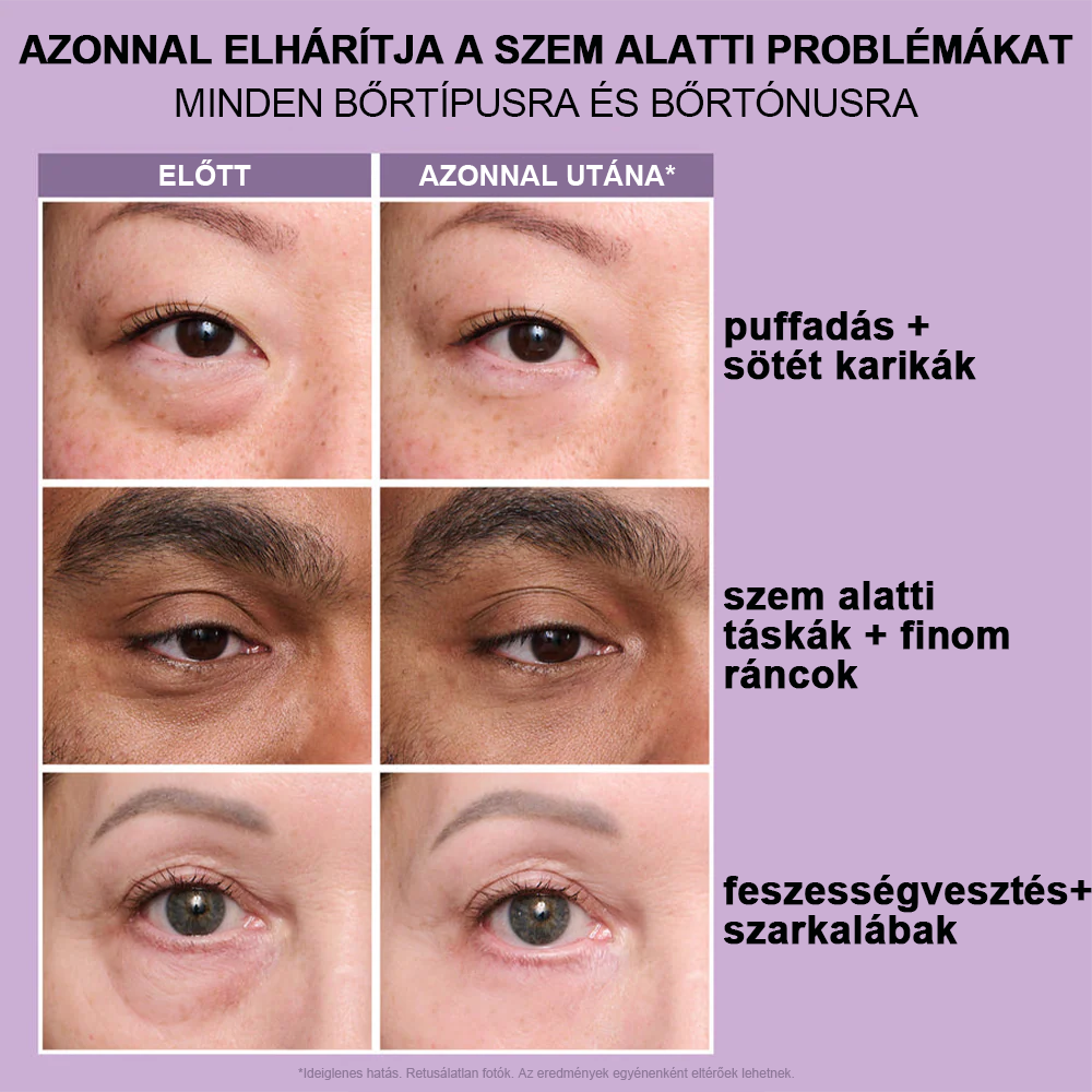 🌸Azonnali Szemkörnyék-Feszesítő Könnyű Formula – Végső Emelés és Sima Befejezés ✨