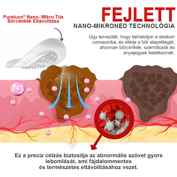Pureluxo® Nano-mikrotűs bőrcímke-eltávolító tapaszok🔸🔸