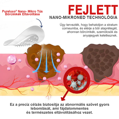 Pureluxo® Nano-mikrotűs bőrcímke-eltávolító tapaszok🔸🔸