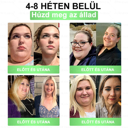 🎄🎄Ajánlott a Semmelweis Kórház által · 👩‍⚕️BENU hivatalos üzlet| 🎁 𝐆𝐞𝑒𝐿𝑒𝐦𝐨𝐧® Glumasetide 8 az 1-ben Karcsú és Egészséges Nano Mikrotűs Tapasz  🎁