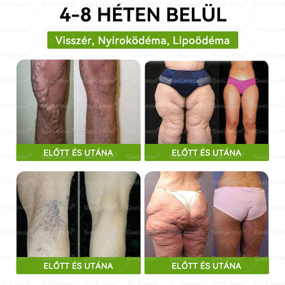🎄🎄Ajánlott a Semmelweis Kórház által · 👩‍⚕️BENU hivatalos üzlet| 🎁 𝐆𝐞𝑒𝐿𝑒𝐦𝐨𝐧® Glumasetide 8 az 1-ben Karcsú és Egészséges Nano Mikrotűs Tapasz  🎁
